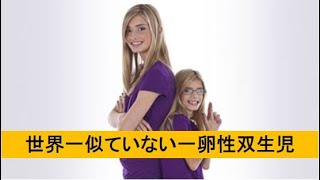 【感動】世界で一番似ていない一卵性双生児。夢は揃って歌手になる事だった。