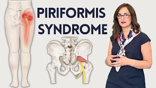#116 How to eliminate lower back pain pain from the piriformis muscle