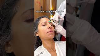 PRP Therapy for Face