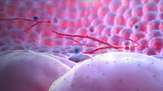 Ebola Virus - Mechanism of Action - 3D Medical Animation