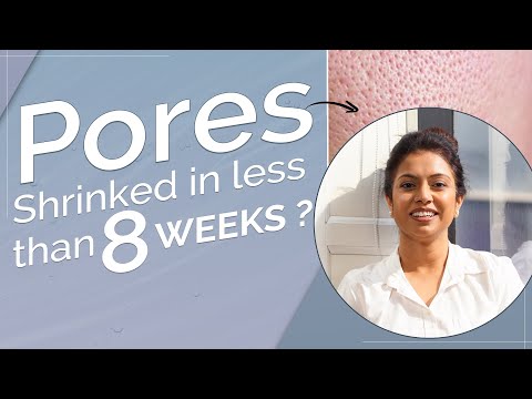 Why Kass Pore Minimizer Serum Is a Skincare Sensation in India!