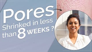 Why Kass Pore Minimizer Serum Is a Skincare Sensation in India!