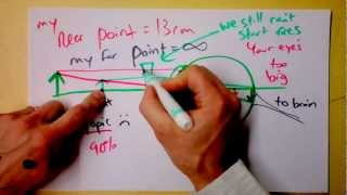 Optometry 101 | Corrective Optics for Myopic and Hyperopic Vision | Doc Physics