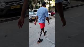 #GeniumX4 microprocessor knee. First fitting in India. | Ottobock