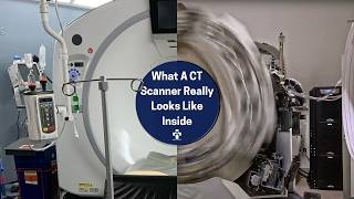How Fast Does A CT Scan Machine Spin? World's Fastest CAT Scanner Spinning Max Speed