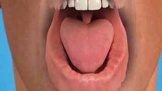 Permanent dental implant | Rajan Dental
