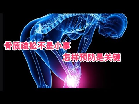 骨质疏松不是小事，怎样预防是关键。