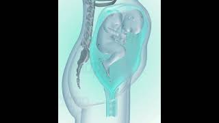 Fetus coming in to birth position (3D Animation)