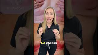 How to fix this red, itchy rash in skin folds called….INTERTRIGO!  #dermatologist #skincare