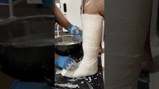 Proses cetak alat bantu sepatu AFO (Ankle Foot Orthosis) | post stroke | Drop foot
