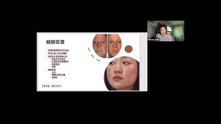 ALI talks 皮膚癌、色素沈澱及皮膚老化 Sep 11