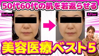 【美肌治療】50代60代でもボロボロなお肌を若返らせる方法ベスト５ | 皮膚科医が解説 | 美容医療 | 肌質改善 | 若返り方法