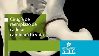 Prótesis de cadera: tipos de implantes, técnica y recuperación