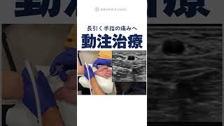 長引く手指の痛みへ動注治療　へバーデン結節　CM関節症　腱鞘炎
