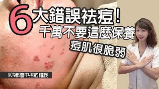 《6大錯誤袪痘法》粉刺痘肌必看!｜痘痘 保養｜痘肌護理2021｜青春痘