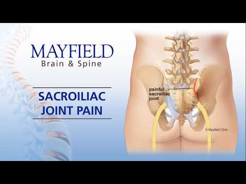 Mayfield Minute: Sacroiliac Joint Pain (SI Joint Pain )