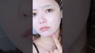 A collection of pimples that don't get hidden even with concealer! Say goodbye to stubborn pimple...