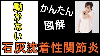 石灰沈着性関節炎の原因と症状は？　岐阜の鍼灸接骨院