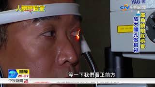 人體實驗室~飛蚊症檢測 眼睛玻璃體退化│中視新聞 20171018