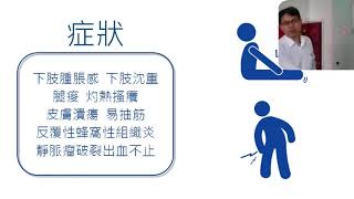 林口長庚醫院 血管外科魏文澄醫師-靜脈曲張健康講座板橋區莊敬里活動中心