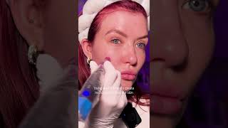 ASMR Facial with PRX Peel