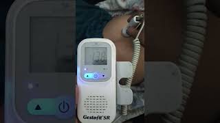 8 month pregnancy#baby heartbeat#shortvideo