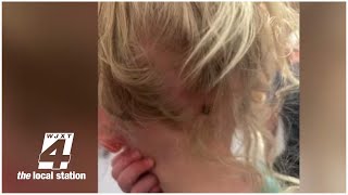 How to spot ticks and remove them
