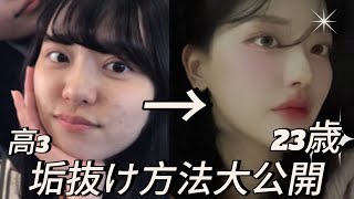 【本気垢抜け】5年かかった垢抜けノウハウ大公開❗️芋脱出/垢抜け方法/韓国メイク/