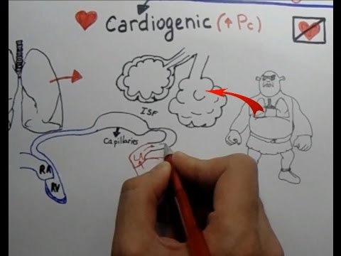 Pulmonary Edema [avicenna-school.com more videos]