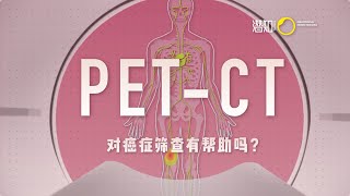 「健康科普」体检的误区和骗局：PET-CT 是什么？对癌症筛查真的有帮助吗？