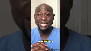 Prevent Ingrown Toenails: Expert Tips for Healthy Feet