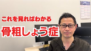 骨粗しょう症〜これを見ればわかる。検査から治療方法まで説明〜