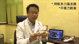 足部健康小貼士 - 健足運動