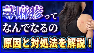 【蕁麻疹】皮膚のかゆみ・かぶれ・発疹...！蕁麻疹の原因と対策【じんましん／かゆみ／かぶれ／発疹】