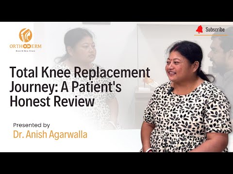 Total Knee Replacement Journey: A Patient's Honest Review | Dr. Anish Agarwalla | Orthoderm
