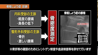 【骨粗しょう症】特集企画「医療のチカラ」骨粗しょう症