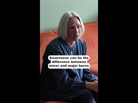 Awareness can be the difference between minor and major burns