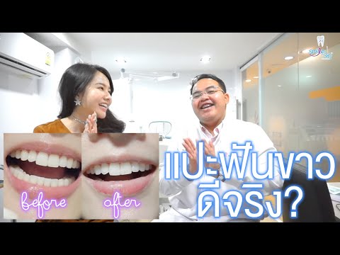 แปะฟันขาวปังหรือพัง ? | erk-erk