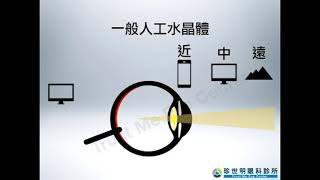 屈光白內障手術 Refractive cataract surgery