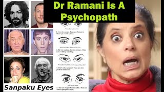 Is Doctor Ramani A Narcissist Psychopath (Sanpaku Eyes Analysis)