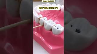 👉LINK: 💬 Dental floss - Dental floss cleaning kit #tooth #waterflossing #dentalfloss #flossing