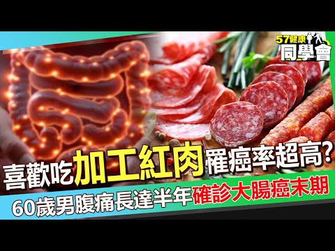 喜歡吃「加工紅肉」小心罹癌率超高？！ 60歲男腹痛長達半年「確診大腸癌末期」癌細胞早轉移肝臟？！【 @57healthy  】#江坤俊 醫師