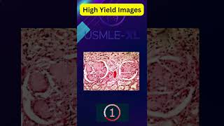 36 #usmlestep1 #medical #firstaid #highyield