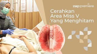 Cerahkan area kewanitaan tanpa rasa khawatir