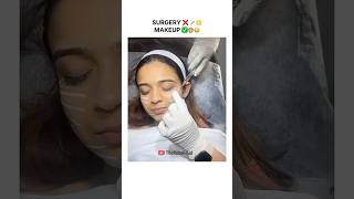 Rebel Kid’s SURGERY ❌ MAKEUP ✅ #therebelkid #apoorvamukhija #samayraina @the.rebelkid