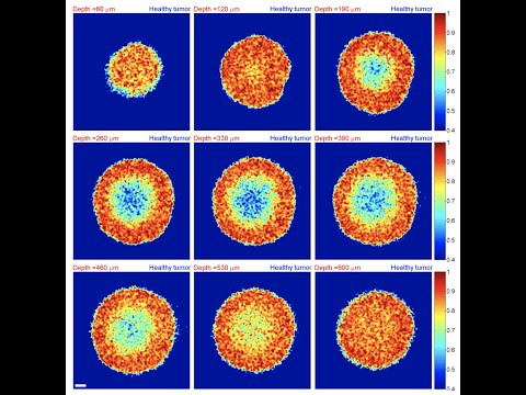 Dynamic Contrast OCT for Cancer Chemotherapy Selection