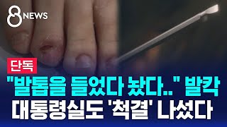 [단독] "발톱을 들었다 놨다.." 발칵…대통령실도 '척결' 나섰다 / SBS 8뉴스