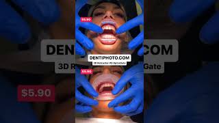 3D Dental Retractor VS OptraGate #dentalphotography #dentalcare #dental #orthodontics #dentalhygiene