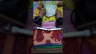 Sepatu CTEV BUAT KAKI PENGKOR #shorts