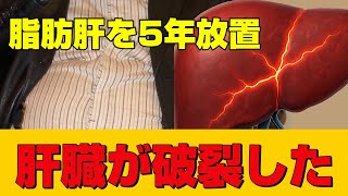 脂肪肝を5年も放置した男性の末路